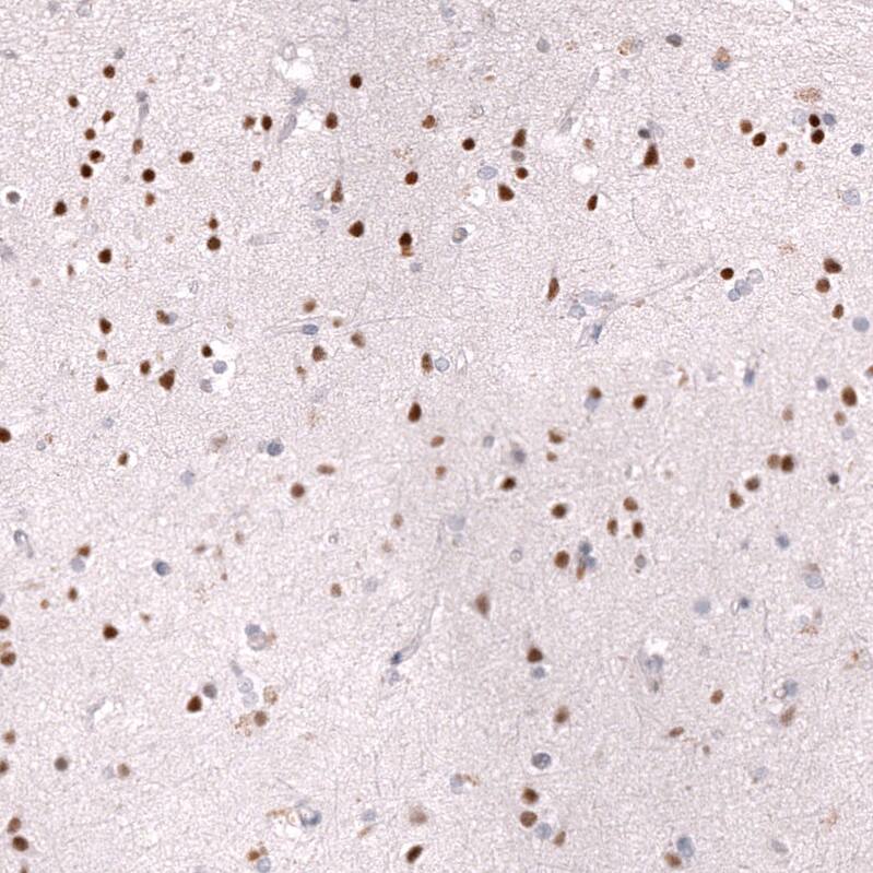 ZEB2 Antibody (CL13467) - Azide and BSA Free Immunohistochemistry-Paraffin: ZEB2 Antibody [NBP3-43869]