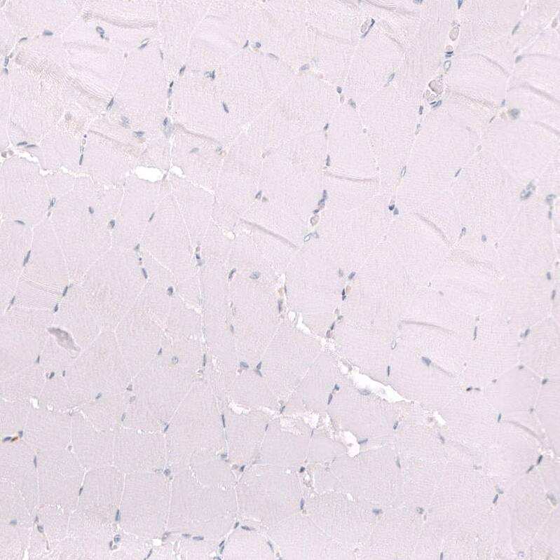 ZEB2 Antibody (CL13467) - Azide and BSA Free Immunohistochemistry-Paraffin: ZEB2 Antibody [NBP3-43869]