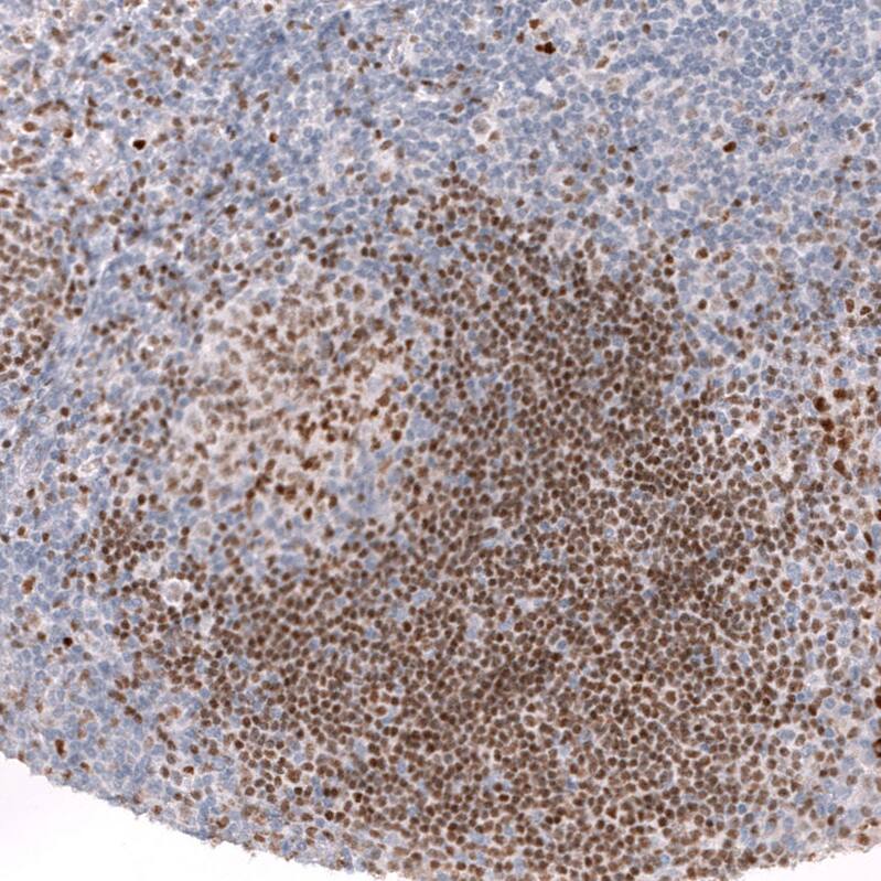 ZEB2 Antibody (CL13467) - Azide and BSA Free Immunohistochemistry-Paraffin: ZEB2 Antibody [NBP3-43869]