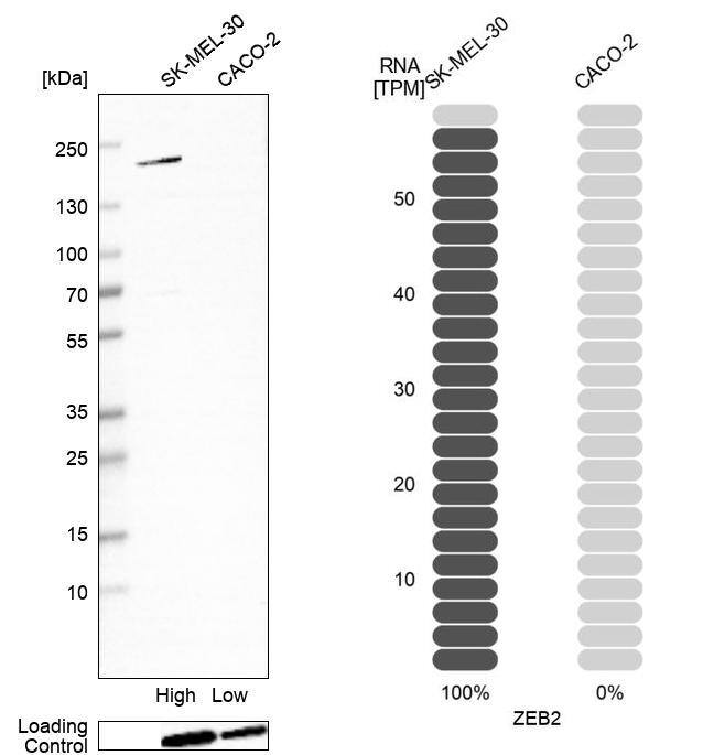 ZEB2 Antibody (CL13467) - Azide and BSA Free Western Blot: ZEB2 Antibody [NBP3-43869]