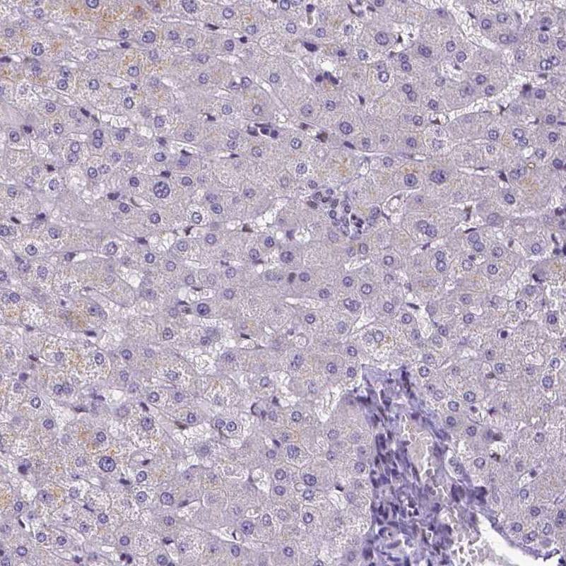 ATRX Antibody (CL0537) - Azide and BSA Free Immunohistochemistry-Paraffin: ATRX Antibody [NBP3-43870]