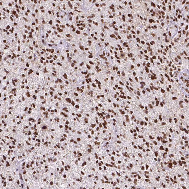 ATRX Antibody (CL0537) - Azide and BSA Free Immunohistochemistry-Paraffin: ATRX Antibody [NBP3-43870]