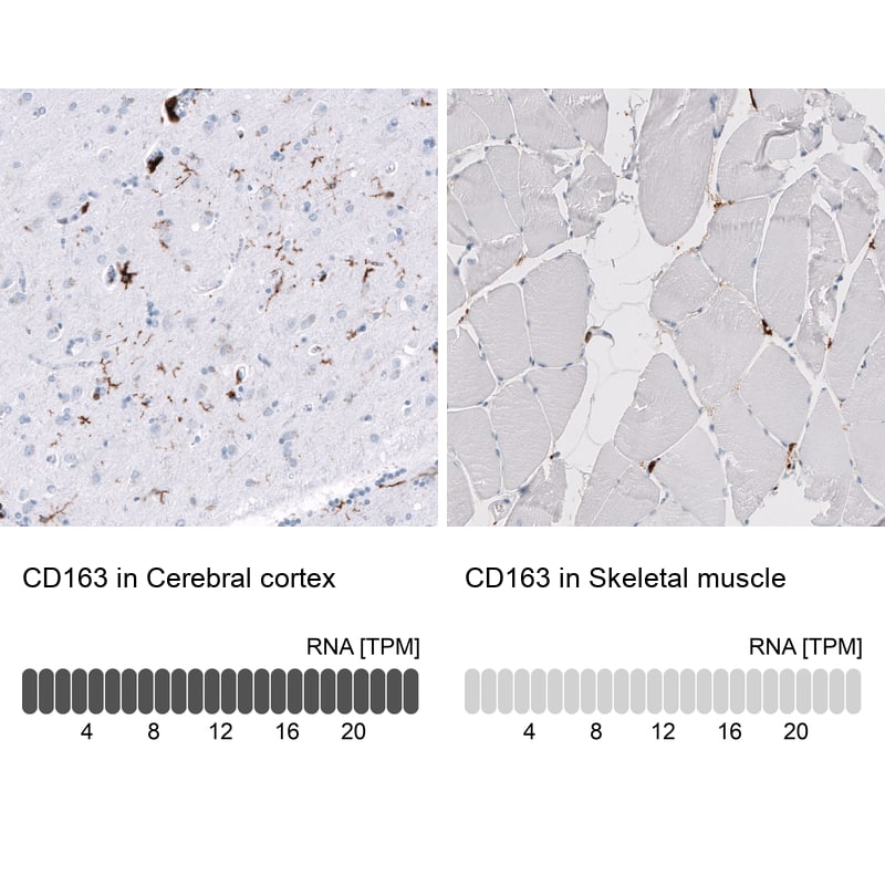 CD163 Antibody (CL10652) - Azide and BSA Free Immunohistochemistry-Paraffin: CD163 Antibody [NBP3-43871]