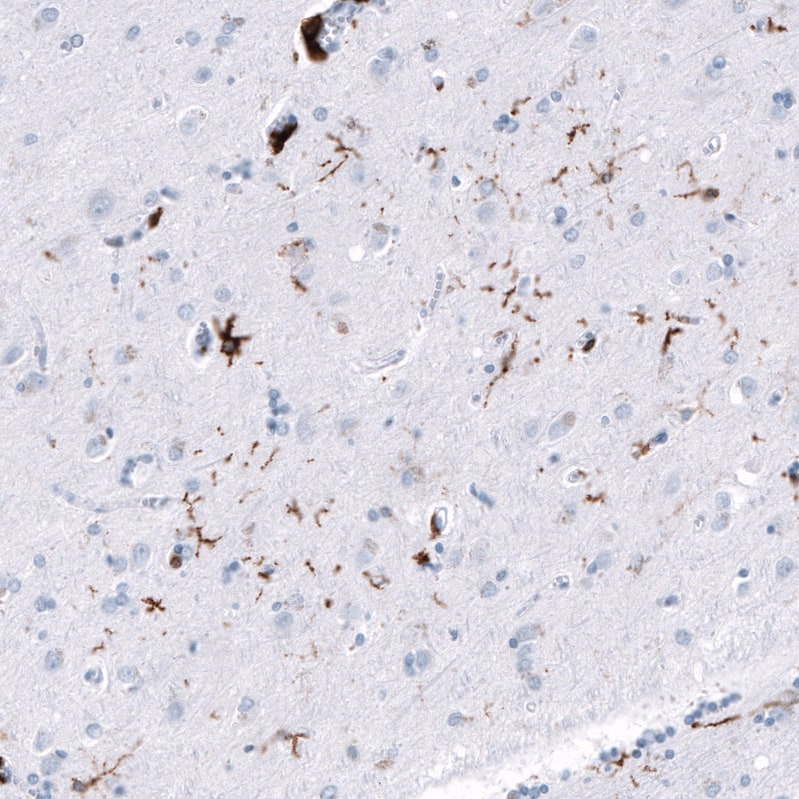 CD163 Antibody (CL10652) - Azide and BSA Free Immunohistochemistry-Paraffin: CD163 Antibody [NBP3-43871]