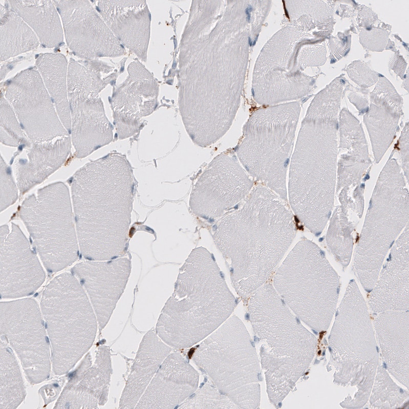 CD163 Antibody (CL10652) - Azide and BSA Free Immunohistochemistry-Paraffin: CD163 Antibody [NBP3-43871]