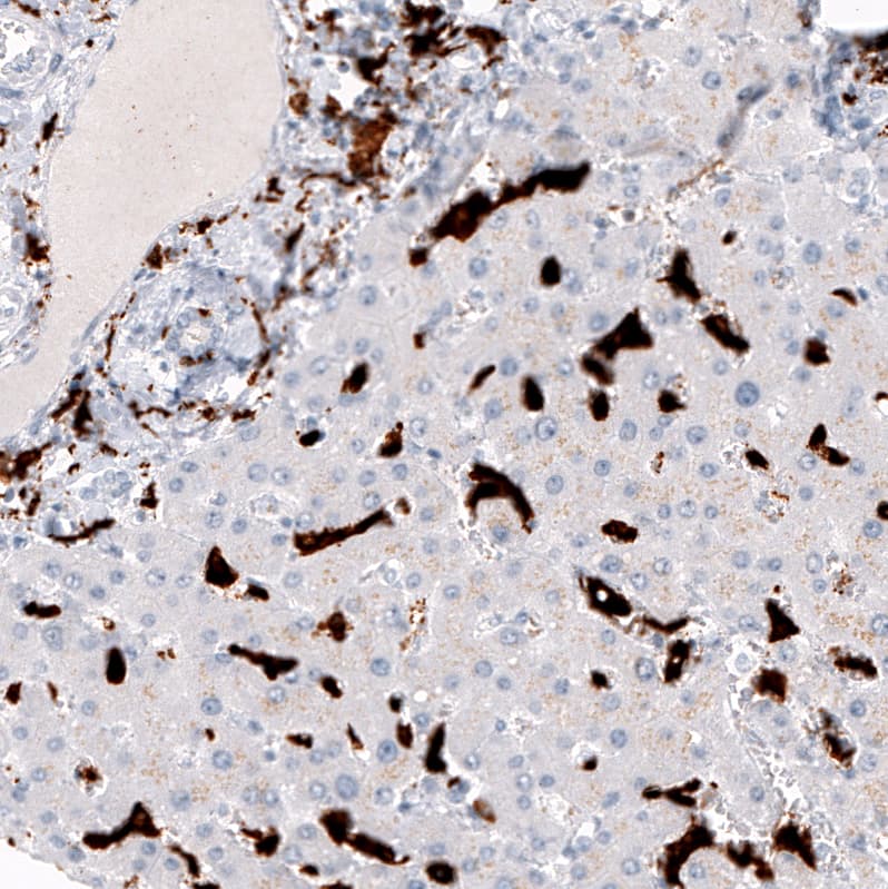 CD163 Antibody (CL10652) - Azide and BSA Free Immunohistochemistry-Paraffin: CD163 Antibody [NBP3-43871]