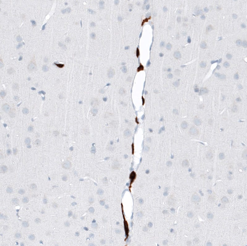 CD163 Antibody (CL10652) - Azide and BSA Free Immunohistochemistry-Paraffin: CD163 Antibody [NBP3-43871]