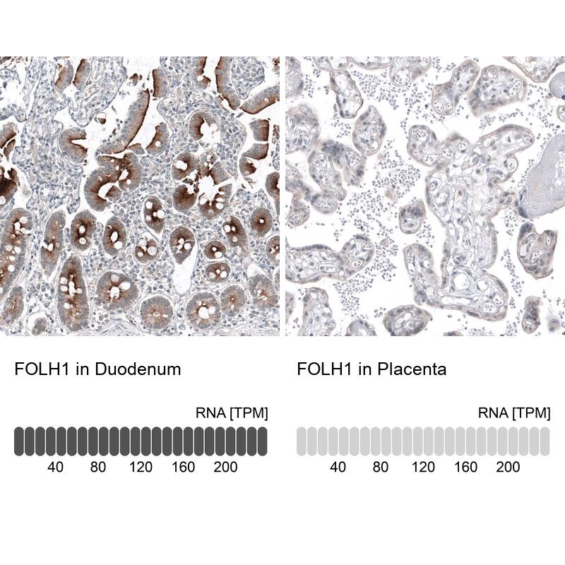 PSMA/FOLH1/NAALADase I Antibody (CL9089) - Azide and BSA Free Immunohistochemistry-Paraffin: PSMA/FOLH1/NAALADase I Antibody [NBP3-43872]