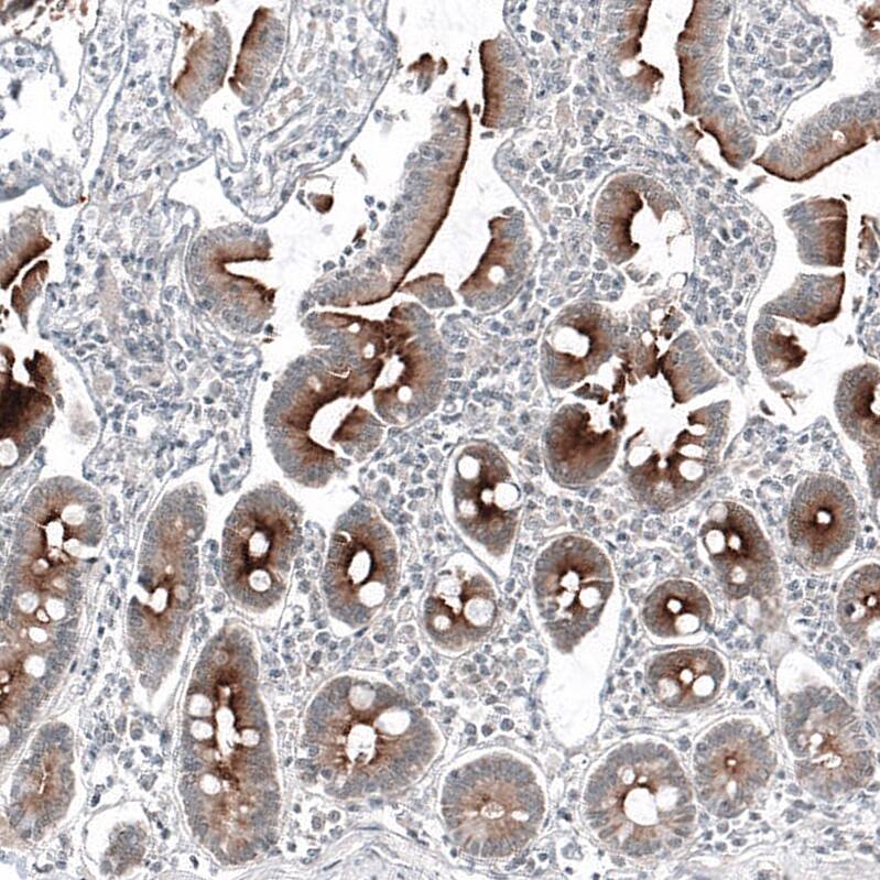 PSMA/FOLH1/NAALADase I Antibody (CL9089) - Azide and BSA Free Immunohistochemistry-Paraffin: PSMA/FOLH1/NAALADase I Antibody [NBP3-43872]