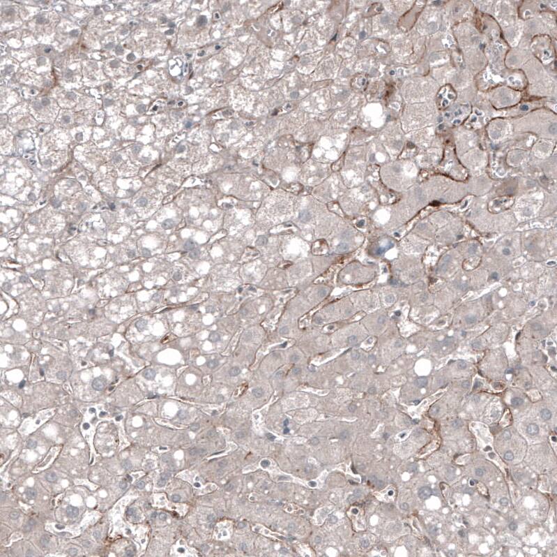PSMA/FOLH1/NAALADase I Antibody (CL9089) - Azide and BSA Free Immunohistochemistry-Paraffin: PSMA/FOLH1/NAALADase I Antibody [NBP3-43872]