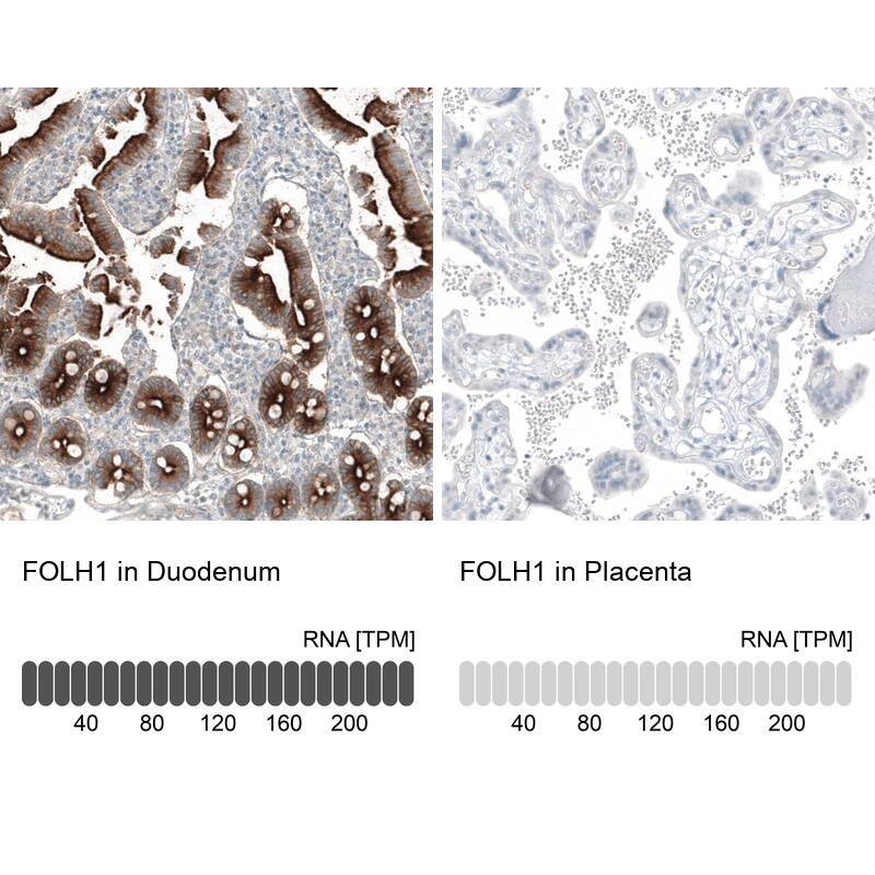 PSMA/FOLH1/NAALADase I Antibody (CL9091) - Azide and BSA Free Immunohistochemistry-Paraffin: PSMA/FOLH1/NAALADase I Antibody [NBP3-43873]