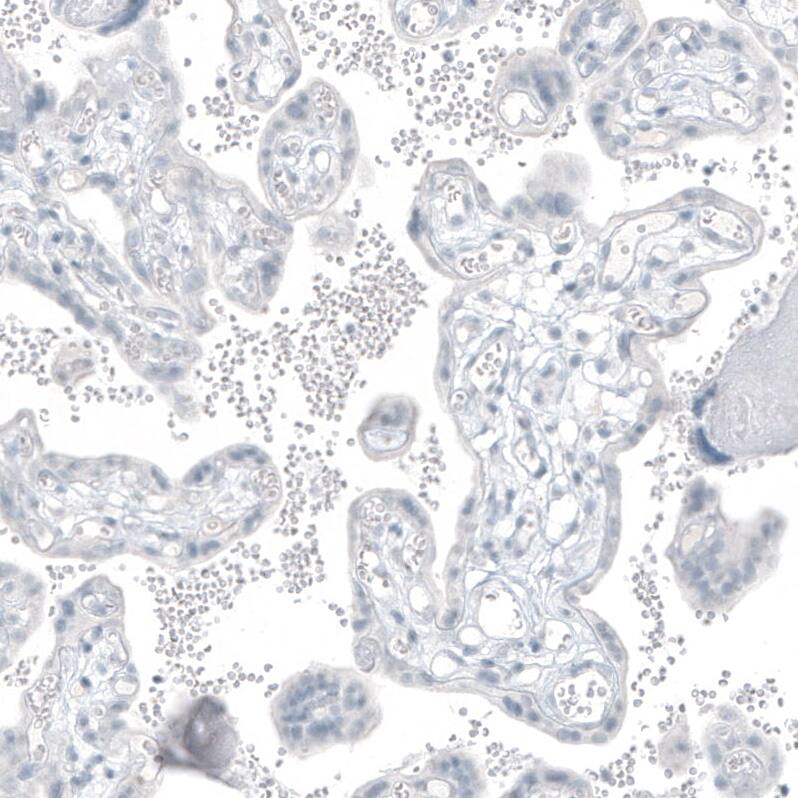 PSMA/FOLH1/NAALADase I Antibody (CL9091) - Azide and BSA Free Immunohistochemistry-Paraffin: PSMA/FOLH1/NAALADase I Antibody [NBP3-43873]