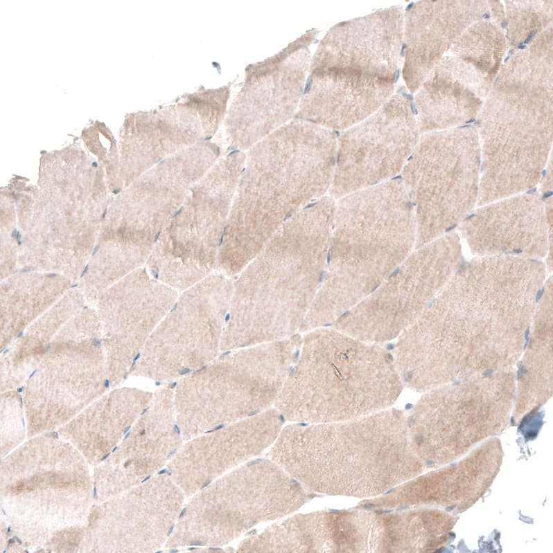 Smad4 Antibody (CL9774) - Azide and BSA Free Immunohistochemistry-Paraffin: Smad4 Antibody [NBP3-43874]