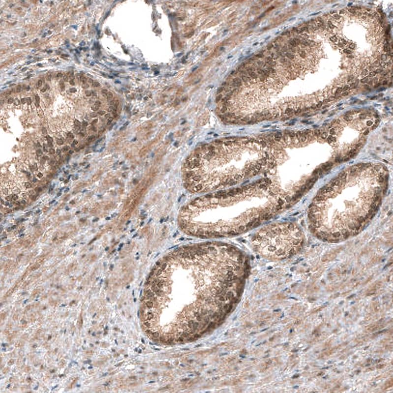 Smad4 Antibody (CL9774) - Azide and BSA Free Immunohistochemistry-Paraffin: Smad4 Antibody [NBP3-43874]