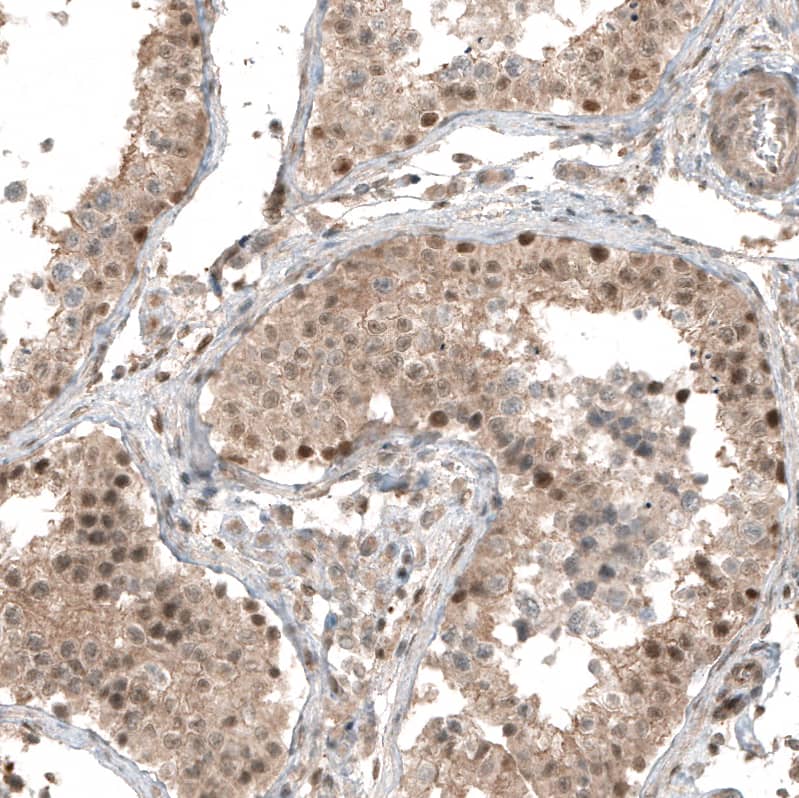 Smad4 Antibody (CL9774) - Azide and BSA Free Immunohistochemistry-Paraffin: Smad4 Antibody [NBP3-43874]