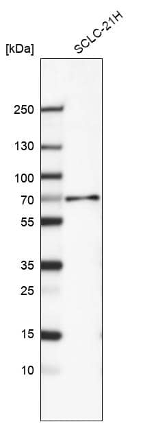 Smad4 Antibody (CL9774) - Azide and BSA Free Western Blot: Smad4 Antibody [NBP3-43874]