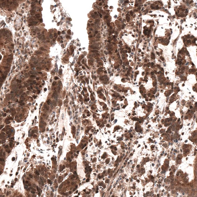 Smad4 Antibody (CL9774) - Azide and BSA Free Immunohistochemistry-Paraffin: Smad4 Antibody [NBP3-43874]