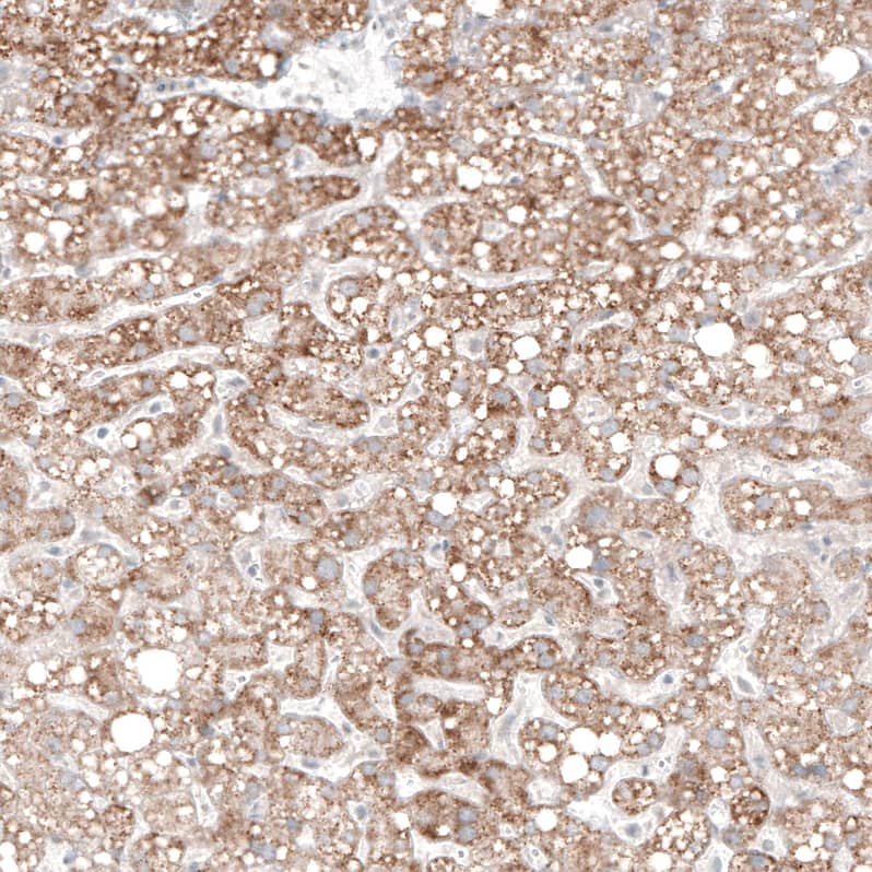 alpha-Methylacyl-CoA Racemase/AMACR Antibody (CL9360) - Azide and BSA Free Immunohistochemistry-Paraffin: alpha-Methylacyl-CoA Racemase/AMACR Antibody [NBP3-43875]