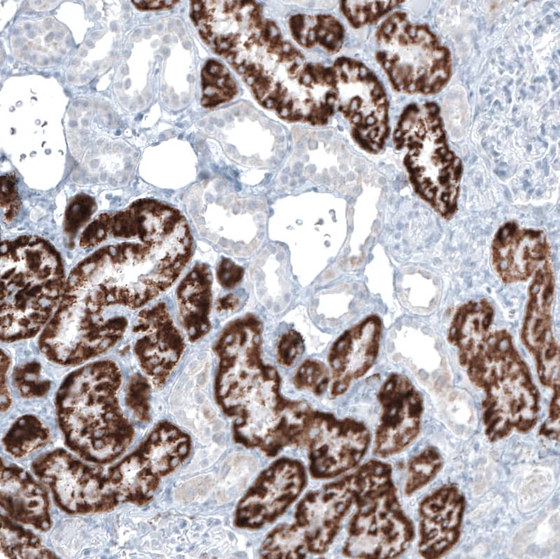 alpha-Methylacyl-CoA Racemase/AMACR Antibody (CL9360) - Azide and BSA Free Immunohistochemistry-Paraffin: alpha-Methylacyl-CoA Racemase/AMACR Antibody [NBP3-43875]