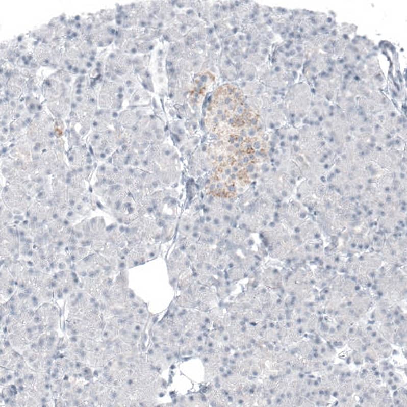 alpha-Methylacyl-CoA Racemase/AMACR Antibody (CL9360) - Azide and BSA Free Immunohistochemistry-Paraffin: alpha-Methylacyl-CoA Racemase/AMACR Antibody [NBP3-43875]