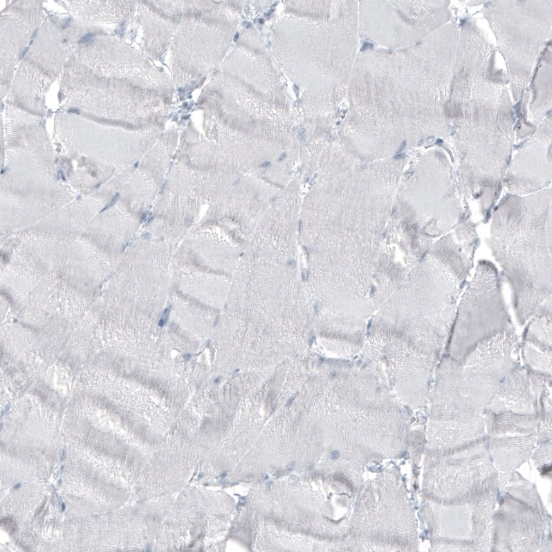 alpha-Methylacyl-CoA Racemase/AMACR Antibody (CL9360) - Azide and BSA Free Immunohistochemistry-Paraffin: alpha-Methylacyl-CoA Racemase/AMACR Antibody [NBP3-43875]