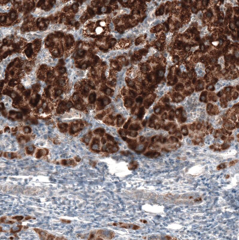 alpha-Methylacyl-CoA Racemase/AMACR Antibody (CL9362) - Azide and BSA Free Immunohistochemistry-Paraffin: alpha-Methylacyl-CoA Racemase/AMACR Antibody [NBP3-43876]