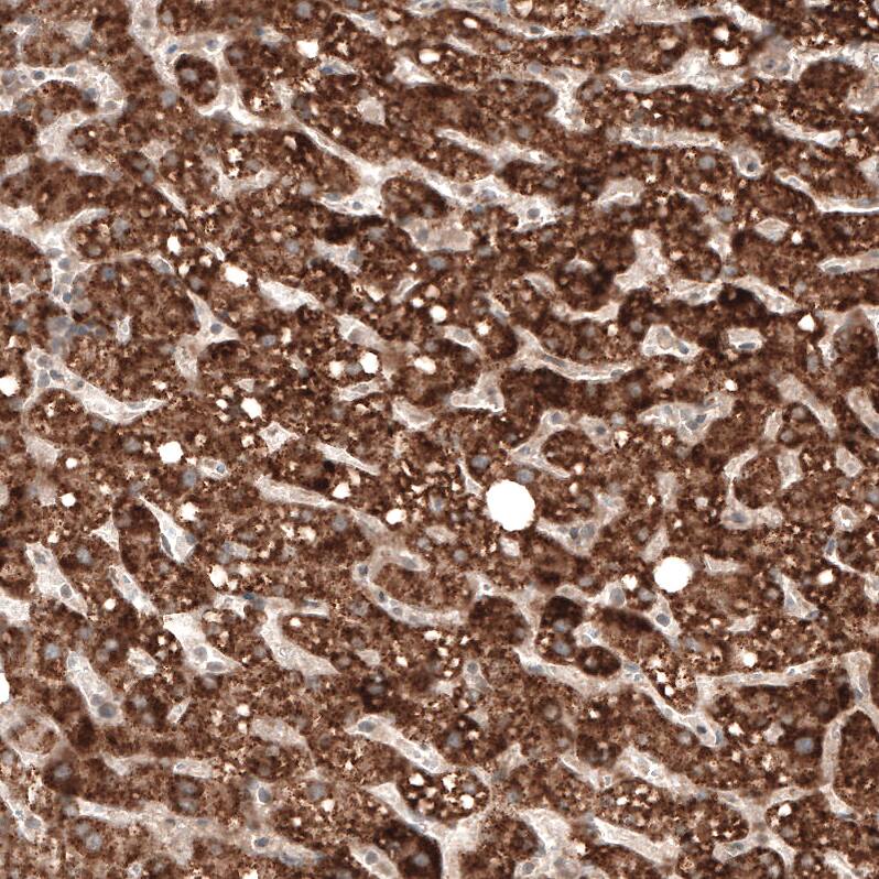 alpha-Methylacyl-CoA Racemase/AMACR Antibody (CL9362) - Azide and BSA Free Immunohistochemistry-Paraffin: alpha-Methylacyl-CoA Racemase/AMACR Antibody [NBP3-43876]