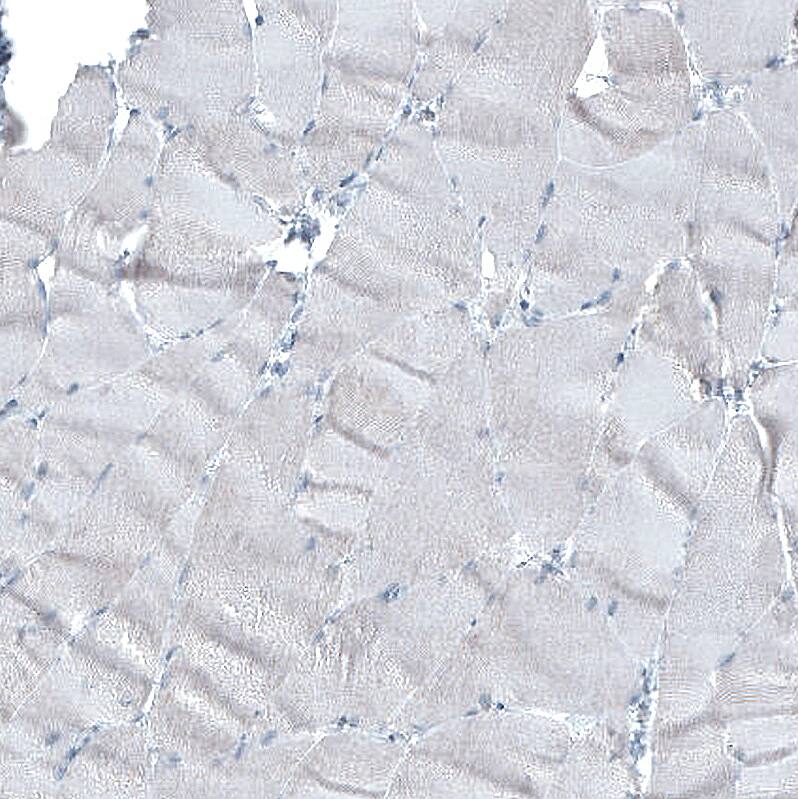alpha-Methylacyl-CoA Racemase/AMACR Antibody (CL9362) - Azide and BSA Free Immunohistochemistry-Paraffin: alpha-Methylacyl-CoA Racemase/AMACR Antibody [NBP3-43876]