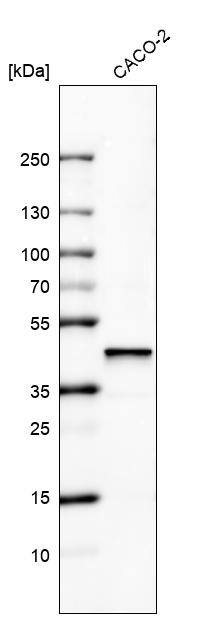 alpha-Methylacyl-CoA Racemase/AMACR Antibody (CL9362) - Azide and BSA Free Western Blot: alpha-Methylacyl-CoA Racemase/AMACR Antibody [NBP3-43876]