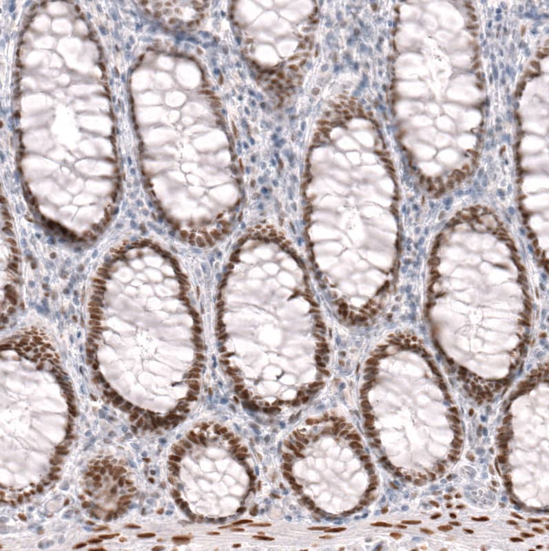 FoxP2 Antibody (CL5312) - Azide and BSA Free Immunohistochemistry-Paraffin: FoxP2 Antibody [NBP3-43878]