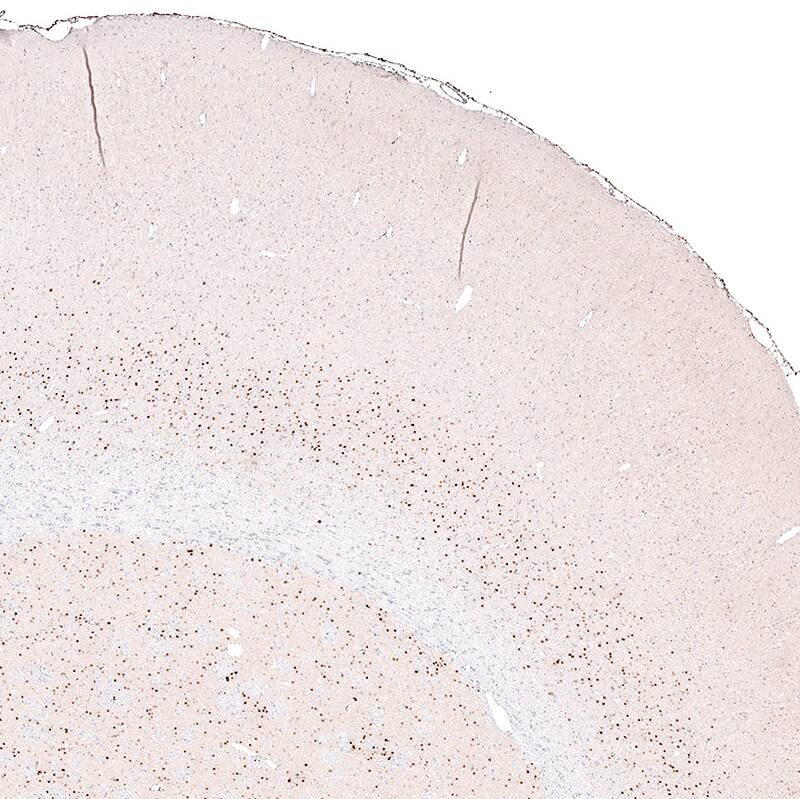 FoxP2 Antibody (CL5312) - Azide and BSA Free Immunohistochemistry-Paraffin: FoxP2 Antibody [NBP3-43878]