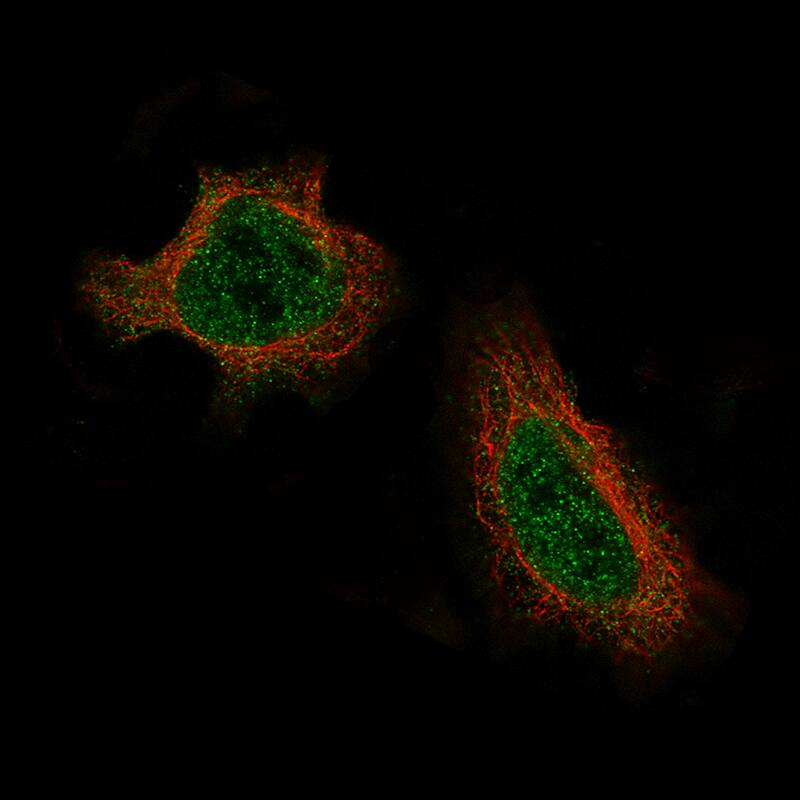 Daxx Antibody (CL3580) - Azide and BSA Free Immunocytochemistry/ Immunofluorescence: Daxx Antibody [NBP3-43879]