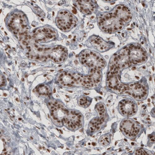 Daxx Antibody (CL3580) - Azide and BSA Free Immunohistochemistry-Paraffin: Daxx Antibody [NBP3-43879]