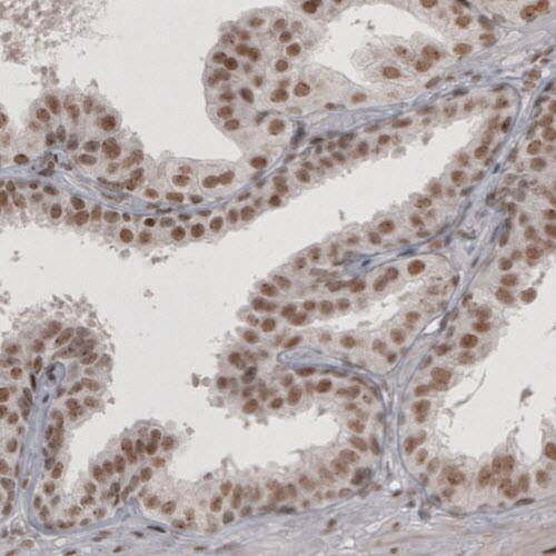 Daxx Antibody (CL3580) - Azide and BSA Free Immunohistochemistry-Paraffin: Daxx Antibody [NBP3-43879]