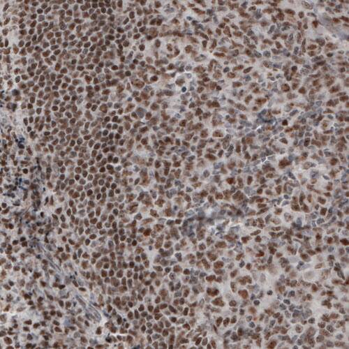 Daxx Antibody (CL3580) - Azide and BSA Free Immunohistochemistry-Paraffin: Daxx Antibody [NBP3-43879]