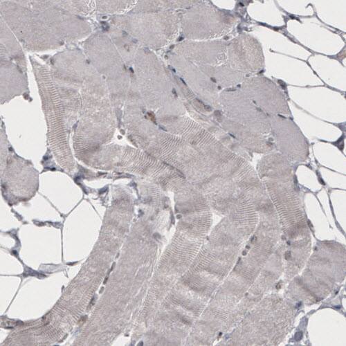 Daxx Antibody (CL3580) - Azide and BSA Free Immunohistochemistry-Paraffin: Daxx Antibody [NBP3-43879]