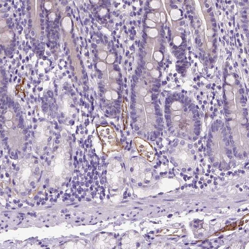 Von Willebrand Factor Antibody (CL1950) - Azide and BSA Free Immunohistochemistry-Paraffin: Von Willebrand Factor Antibody [NBP3-43880]