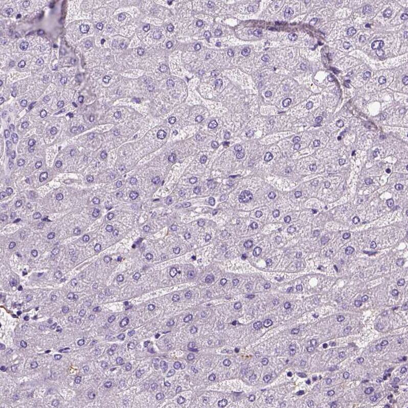 Von Willebrand Factor Antibody (CL1950) - Azide and BSA Free Immunohistochemistry-Paraffin: Von Willebrand Factor Antibody [NBP3-43880]