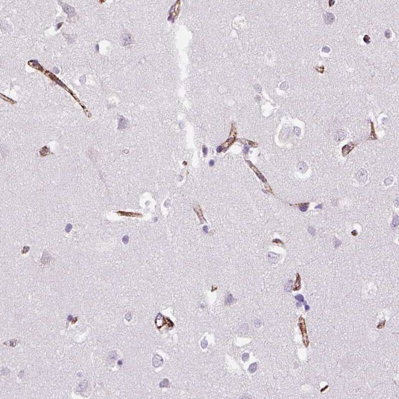 Von Willebrand Factor Antibody (CL1950) - Azide and BSA Free Immunohistochemistry-Paraffin: Von Willebrand Factor Antibody [NBP3-43880]