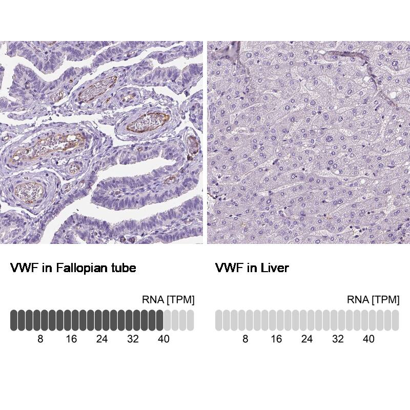 Von Willebrand Factor Antibody (CL1950) - Azide and BSA Free Immunohistochemistry-Paraffin: Von Willebrand Factor Antibody [NBP3-43880]