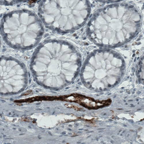 Von Willebrand Factor Antibody (CL1957) - Azide and BSA Free Immunohistochemistry-Paraffin: Von Willebrand Factor Antibody [NBP3-43881]