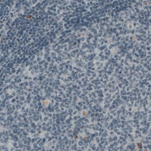 Von Willebrand Factor Antibody (CL1957) - Azide and BSA Free Immunohistochemistry-Paraffin: Von Willebrand Factor Antibody [NBP3-43881]