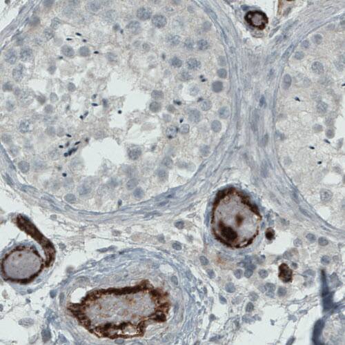 Von Willebrand Factor Antibody (CL1957) - Azide and BSA Free Immunohistochemistry-Paraffin: Von Willebrand Factor Antibody [NBP3-43881]