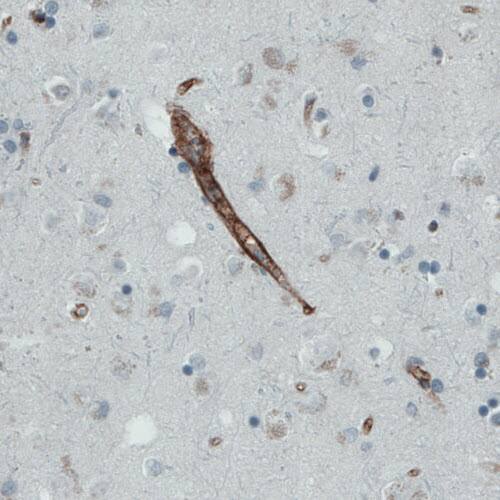 Endoglin/CD105 Antibody (CL1912) - Azide and BSA Free Immunohistochemistry-Paraffin: Endoglin/CD105 Antibody [NBP3-43882]