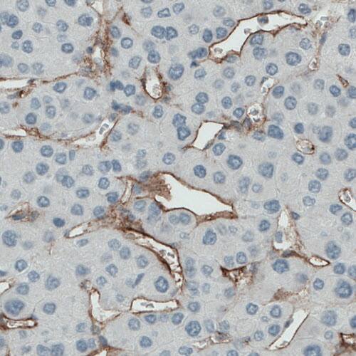 Endoglin/CD105 Antibody (CL1912) - Azide and BSA Free Immunohistochemistry-Paraffin: Endoglin/CD105 Antibody [NBP3-43882]