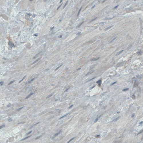 Endoglin/CD105 Antibody (CL1912) - Azide and BSA Free Immunohistochemistry-Paraffin: Endoglin/CD105 Antibody [NBP3-43882]