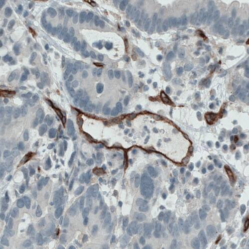 Endoglin/CD105 Antibody (CL1912) - Azide and BSA Free Immunohistochemistry-Paraffin: Endoglin/CD105 Antibody [NBP3-43882]