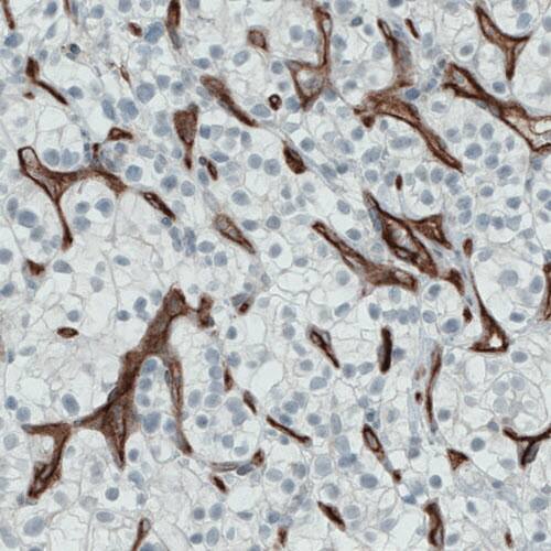 Endoglin/CD105 Antibody (CL1912) - Azide and BSA Free Immunohistochemistry-Paraffin: Endoglin/CD105 Antibody [NBP3-43882]
