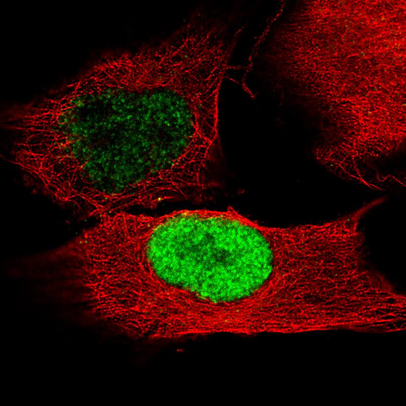 POU3F2/OCT7 Antibody (CL6232) - Azide and BSA Free Immunocytochemistry/ Immunofluorescence: POU3F2/OCT7 Antibody [NBP3-43884]