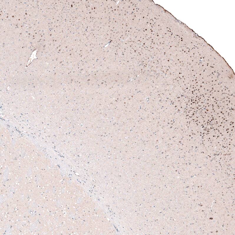 POU3F2/OCT7 Antibody (CL6232) - Azide and BSA Free Immunohistochemistry-Paraffin: POU3F2/OCT7 Antibody [NBP3-43884]